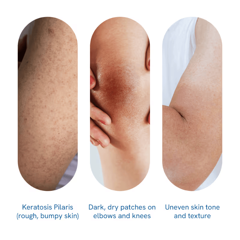 Top Natural Body Care Solutions for Women in India: Featuring Be Bodywise