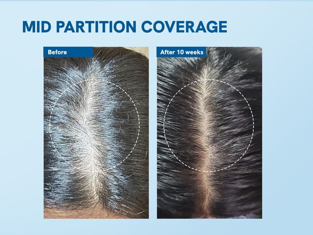 Be Bodywise Hair & Roll-On Routine: Dermatologist-Designed Guide for Women