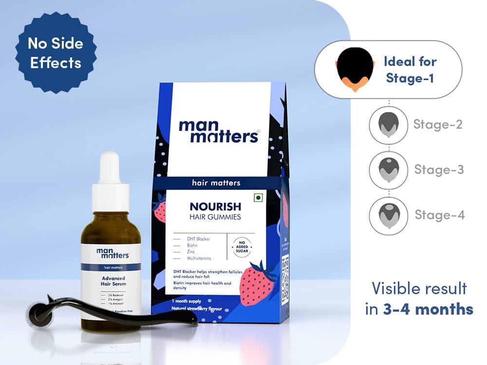 Man Matters Minoxidil: India’s Alcohol Free, Dermatologist Guided Hair Regrowth Solution