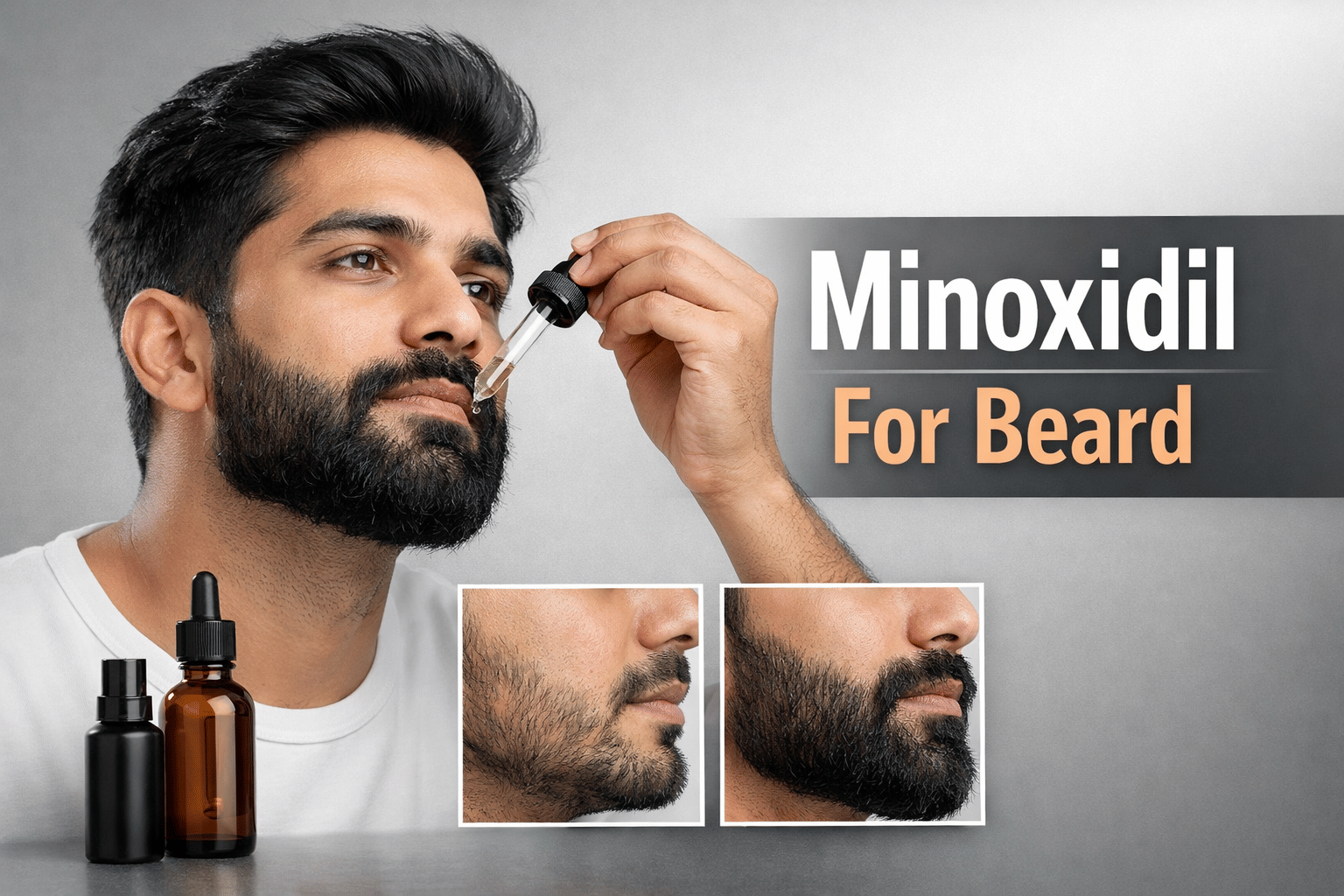 Minoxidil For Beard: A Complete Guide (2026)