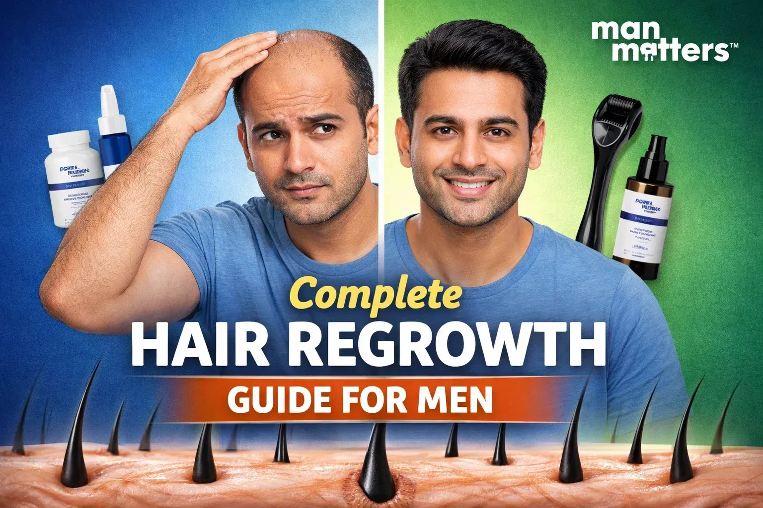 Complete Hair Regrowth Guide for Men (2026) - Science-Backed Solutions