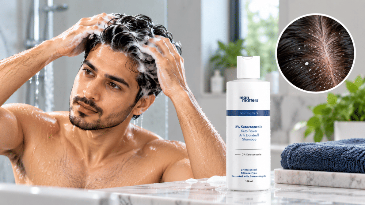 Man washing his hair with 2% Ketoconazole Anti-Dandruff Shampoo, to reduce dandruff.