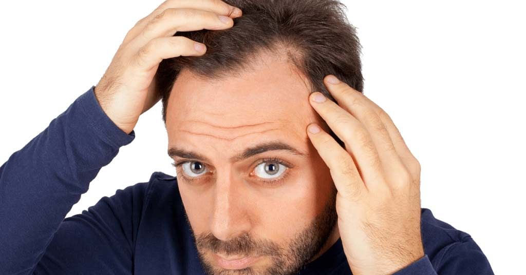 Can dandruff cause hair loss?