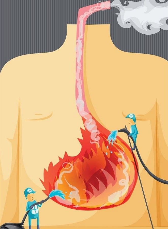 Hyperacidity: Causes, Symptoms, Treatment & More