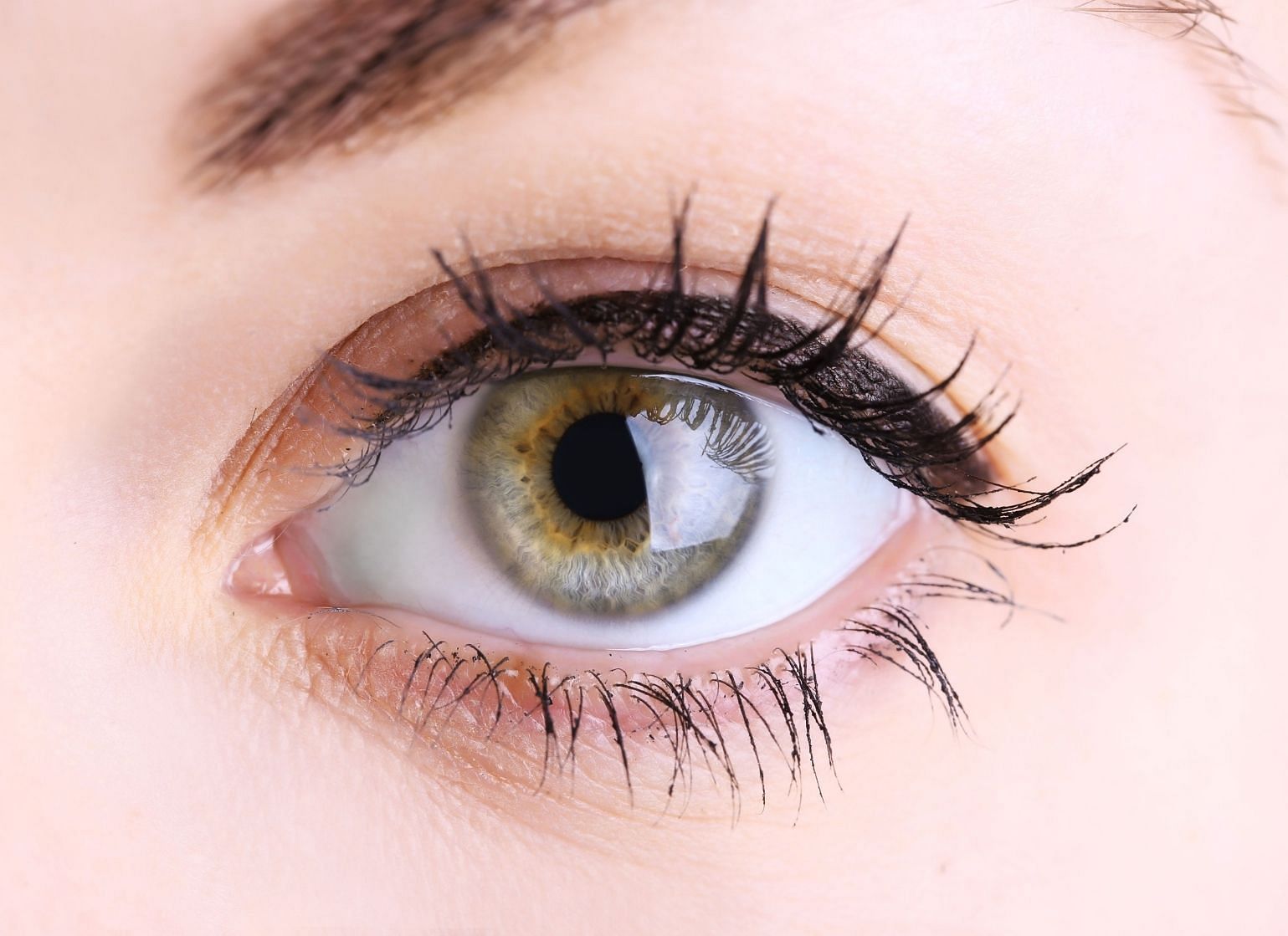 White Spot on Eye: Causes & Treatment - Man Matters