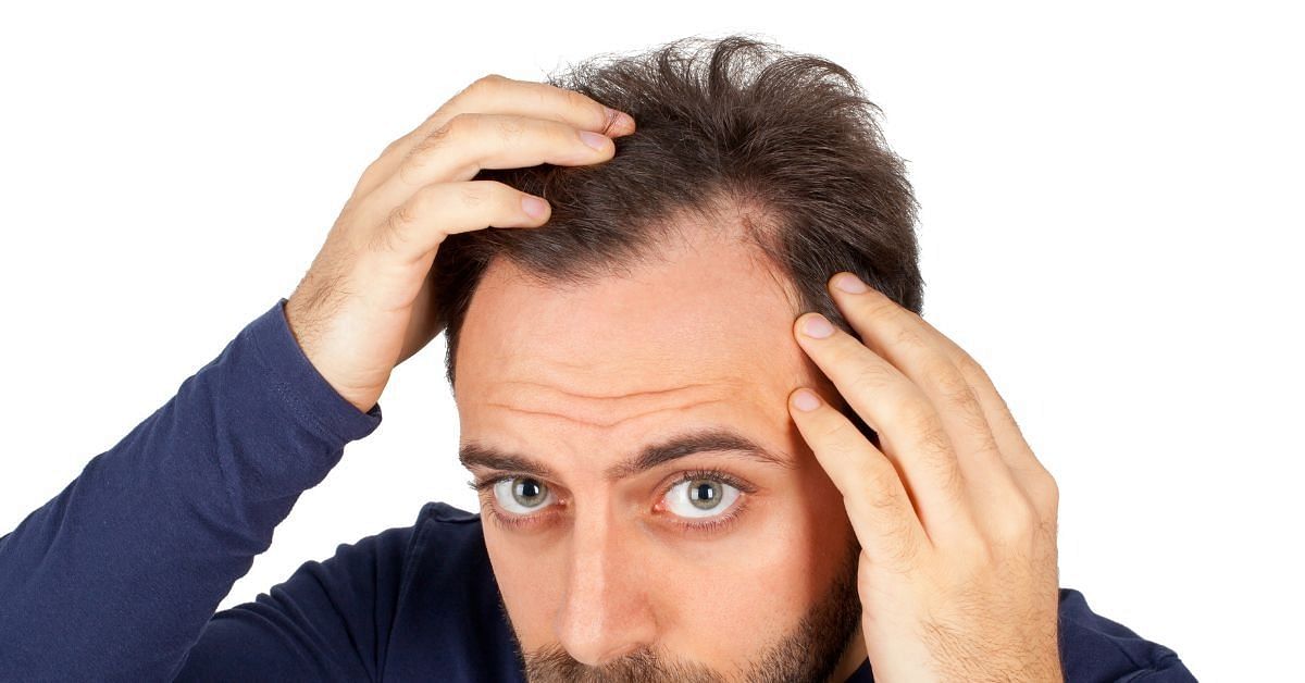 Itching Scalp and Hair Loss: What is the Link? Causes & Treatment